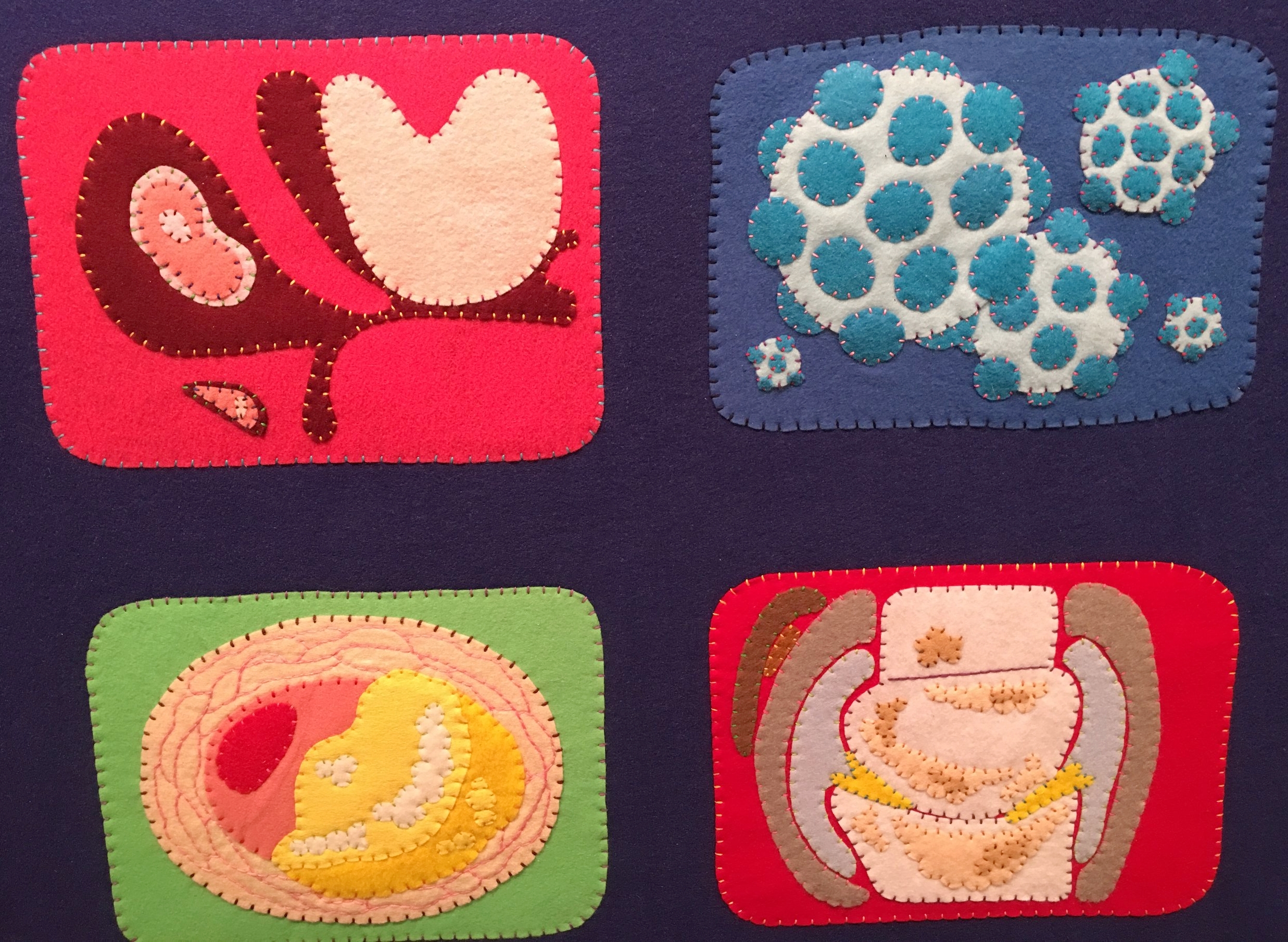  Conditions depicted (clockwise from upper-left): sleep apnea, hepatitis, coronary artery disease, and rheumatoid arthritis. 