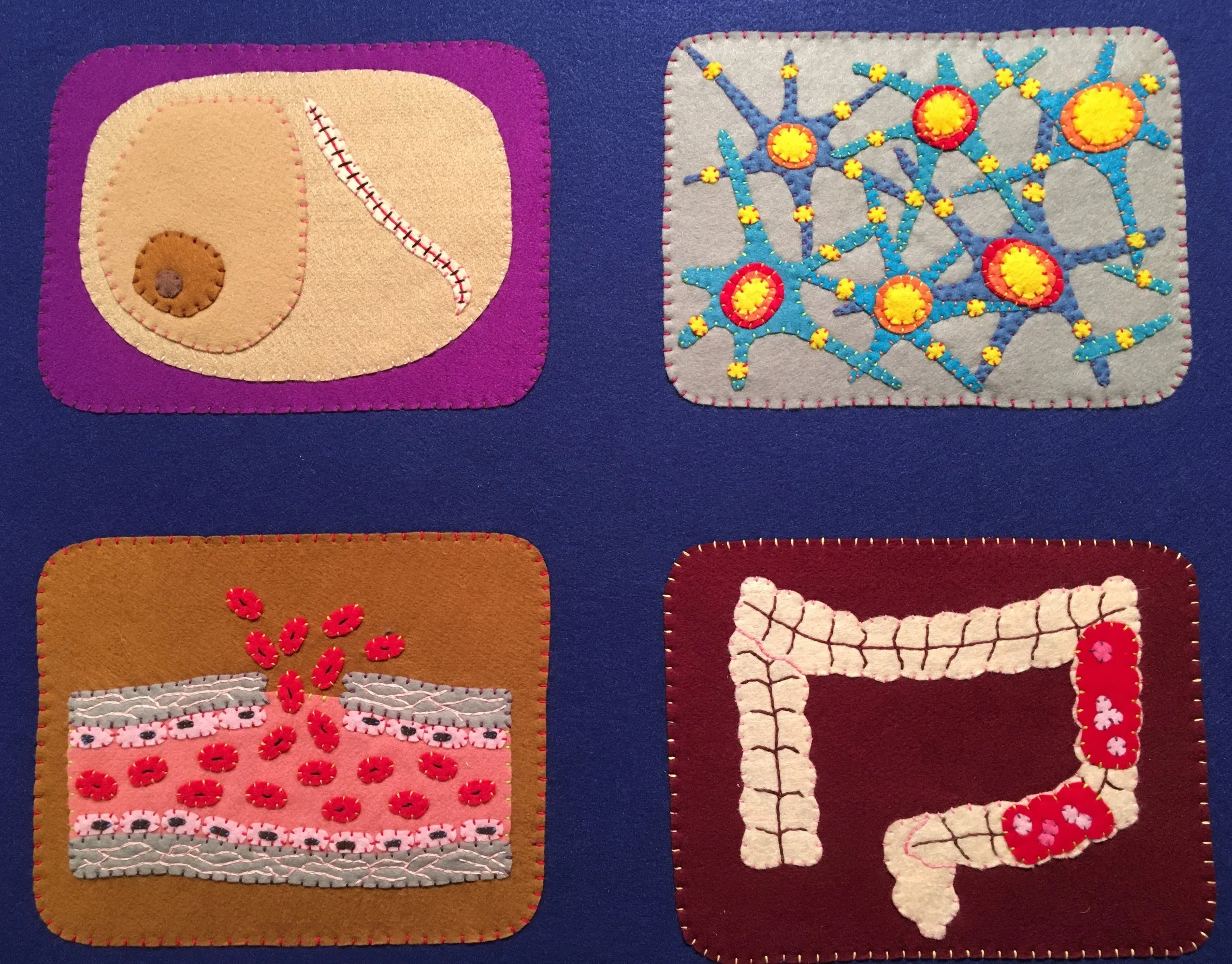  Conditions depicted (clockwise from upper-left): breast cancer, schizophrenia, hemophilia, and ulcerative colitis. 