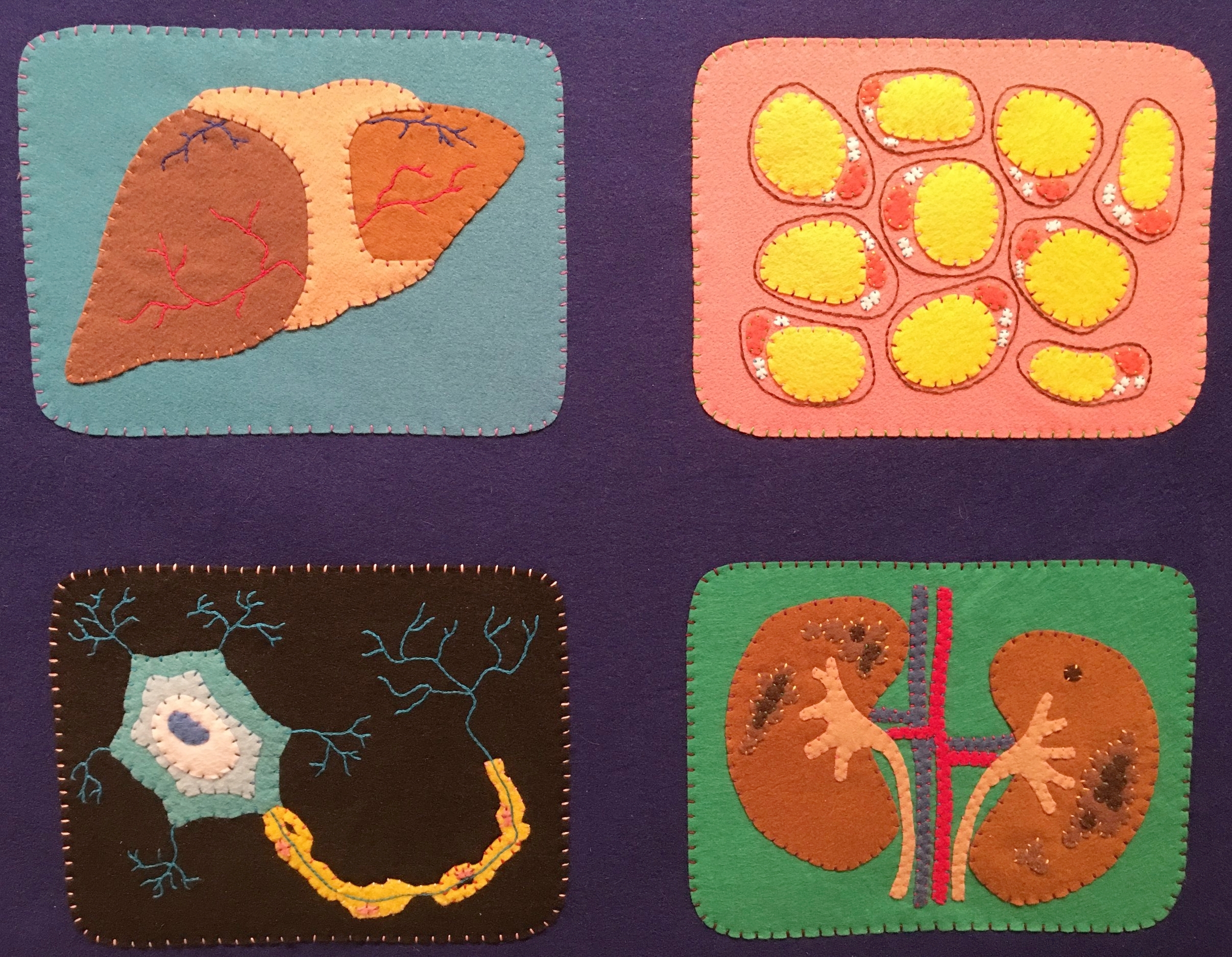  Conditions depicted (clockwise from upper-left): organ transplant, obesity, multiple sclerosis, and polycystic kidney disease. 