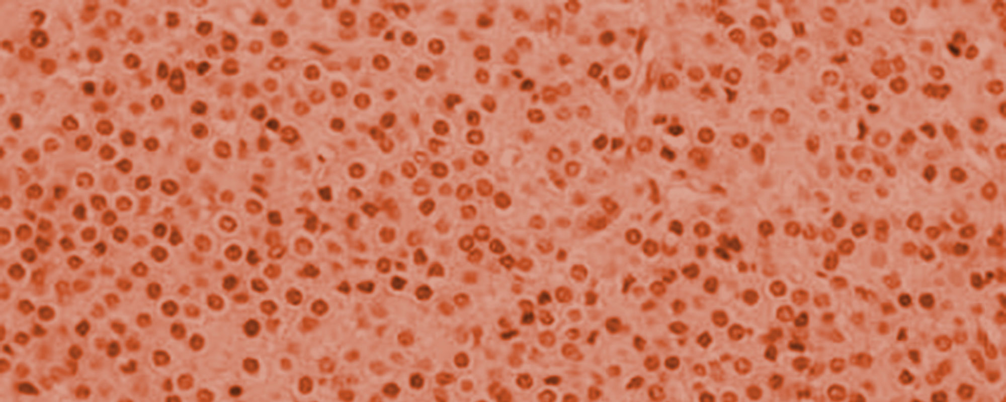 npb_banner_healthy_cells_red-2000x800.jpg