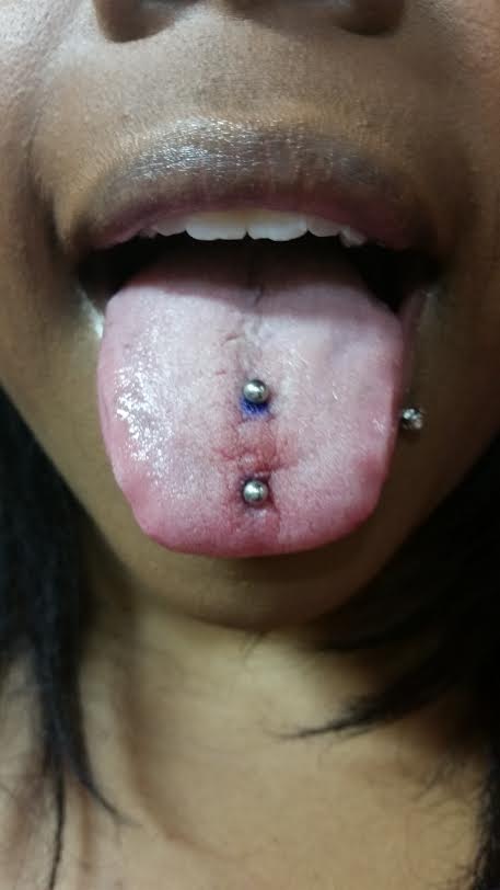 Surface Tongue