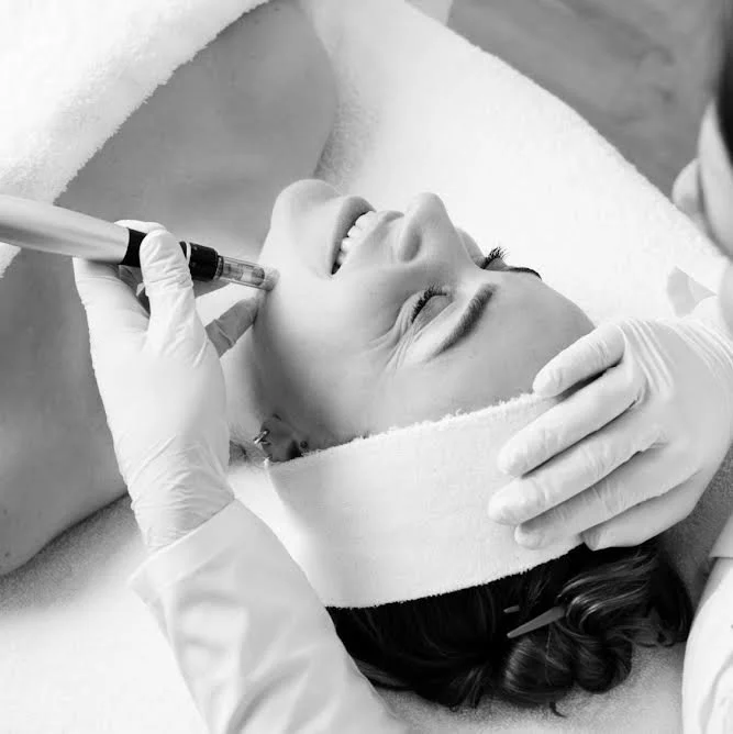 Microneedling