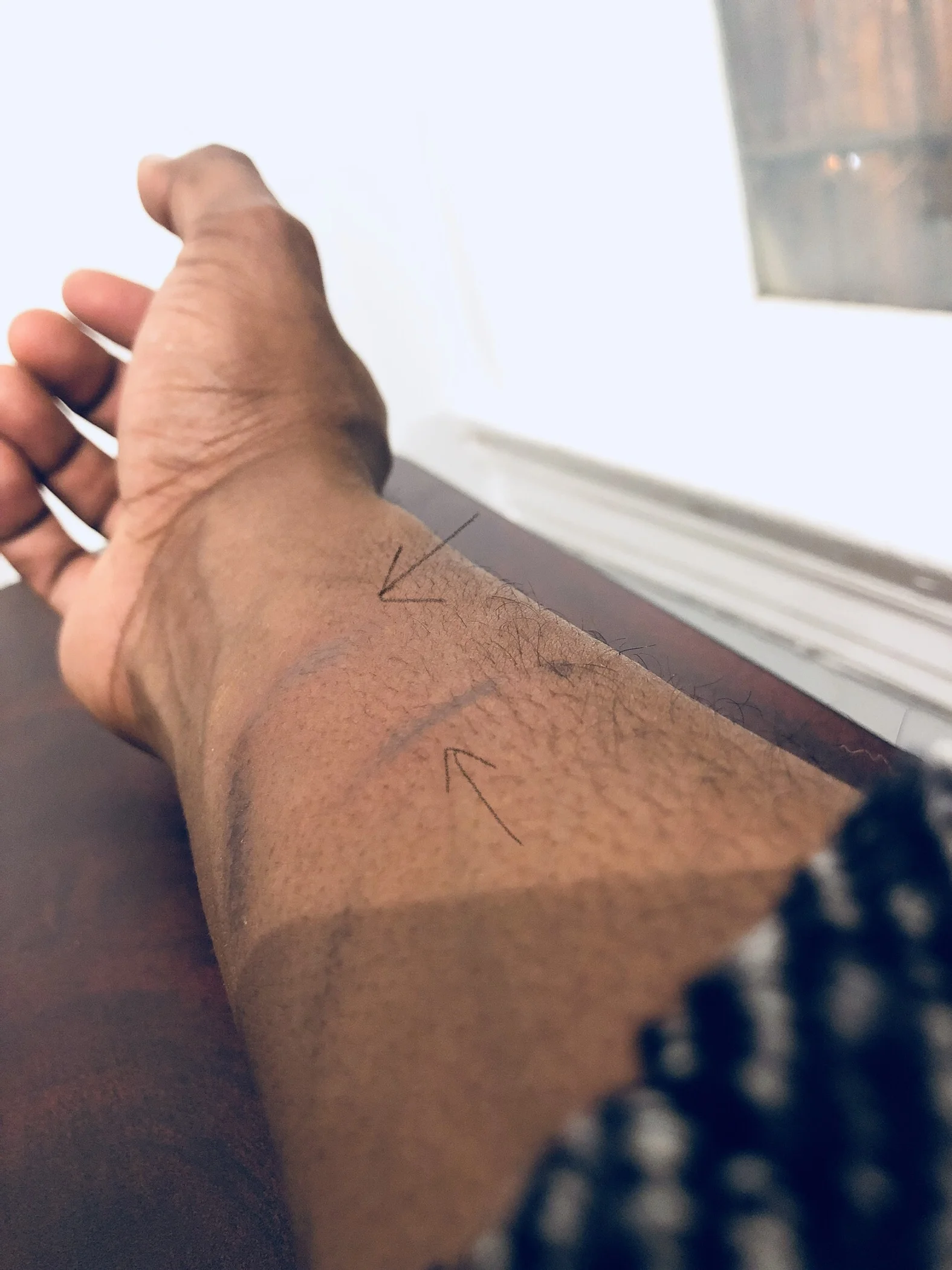 Having to draw arrows on the photo to denote which scars were newest is its own problem. 