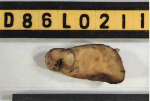 Tip of finger found near Lake Zoar.