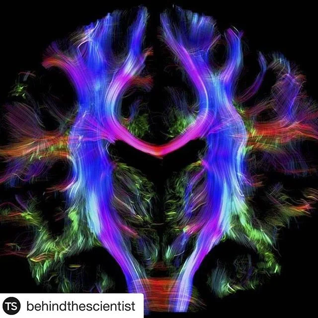 #Repost @behindthescientist &iquest;Qu&eacute; me dices de esta imagen de todas los caminos que siguen las c&eacute;lulas en tu cerebro? &iexcl;Feliz lunes! #belleza #cerebro #arte #ciencia #felizlunes #medicina #cienciapalabanda #decolores #incre&ia