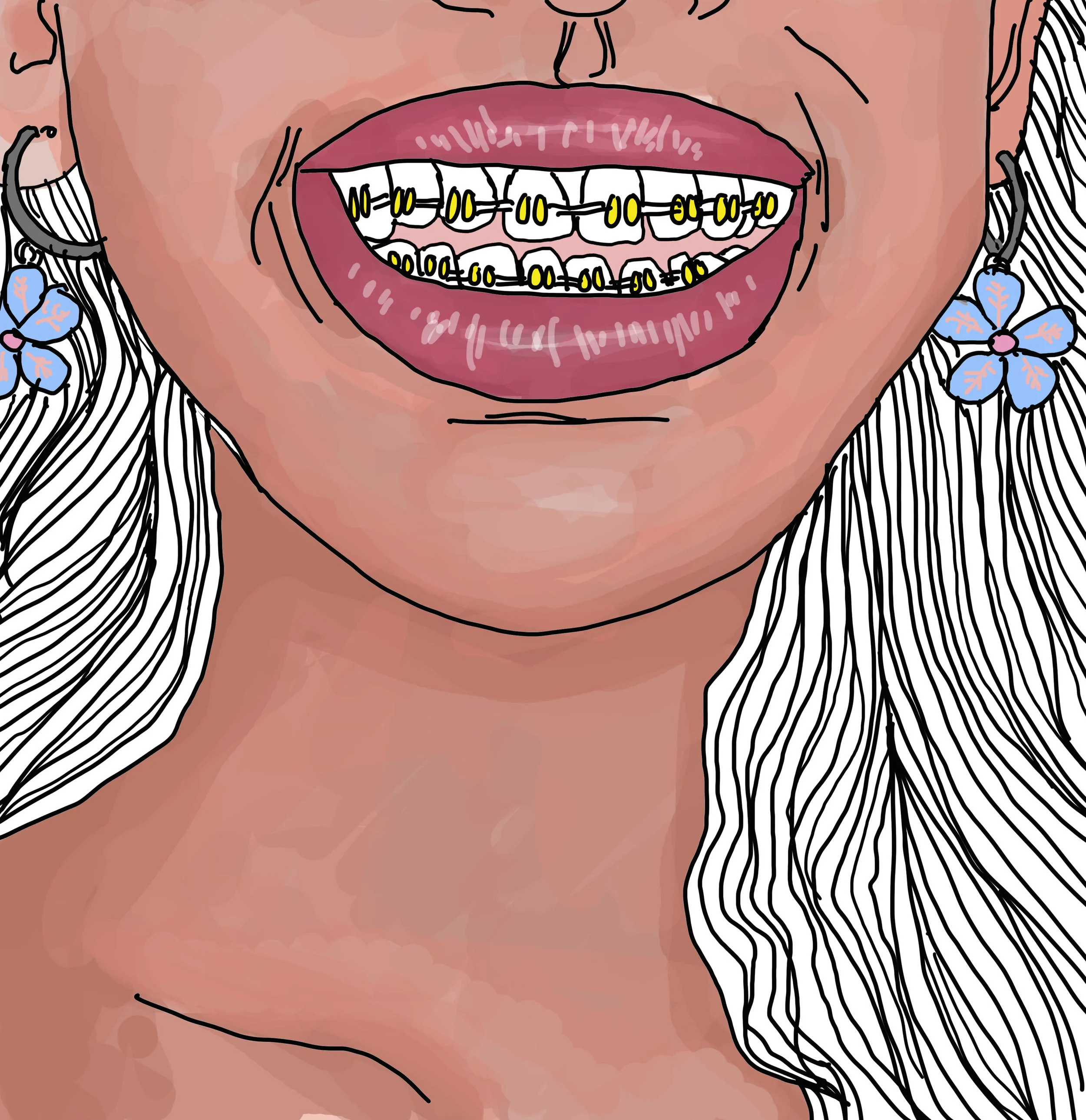 BRACES.jpg