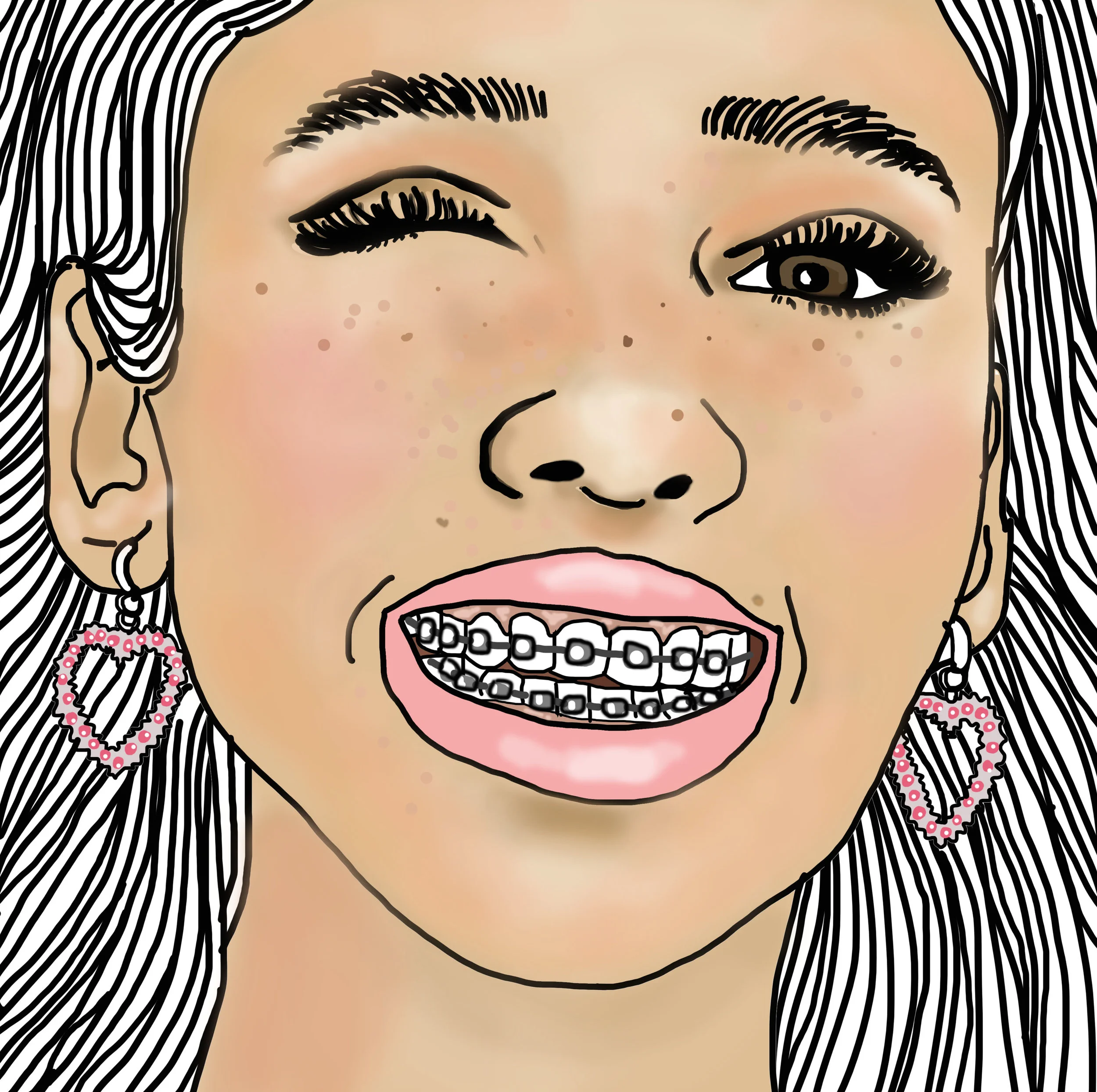 braces2.jpg