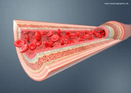 Limb Ischemia