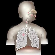 The Two Types of Lung Cancer