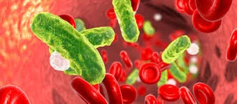 Sepsis