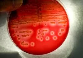Methicillin Resistant Staphylococcus Aureus (MRSA)