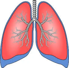 Radon-Induced Lung Cancer