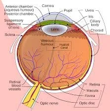 Relative afferent pupillary defect (RAPD or APD) — Medilex: The Experts ...