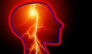 Epileptology Medical Experts