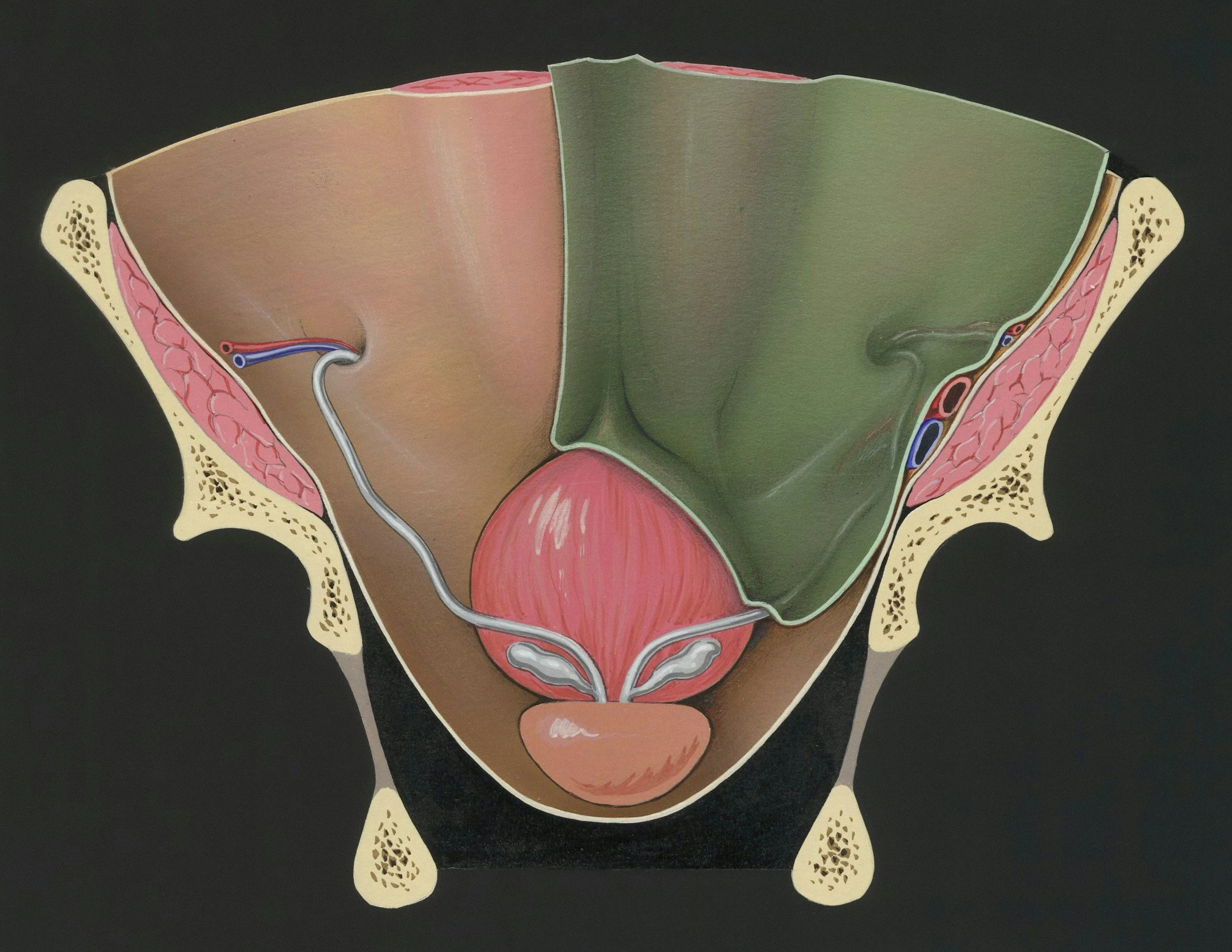 Cervical Cancer Screening with Pap Smear