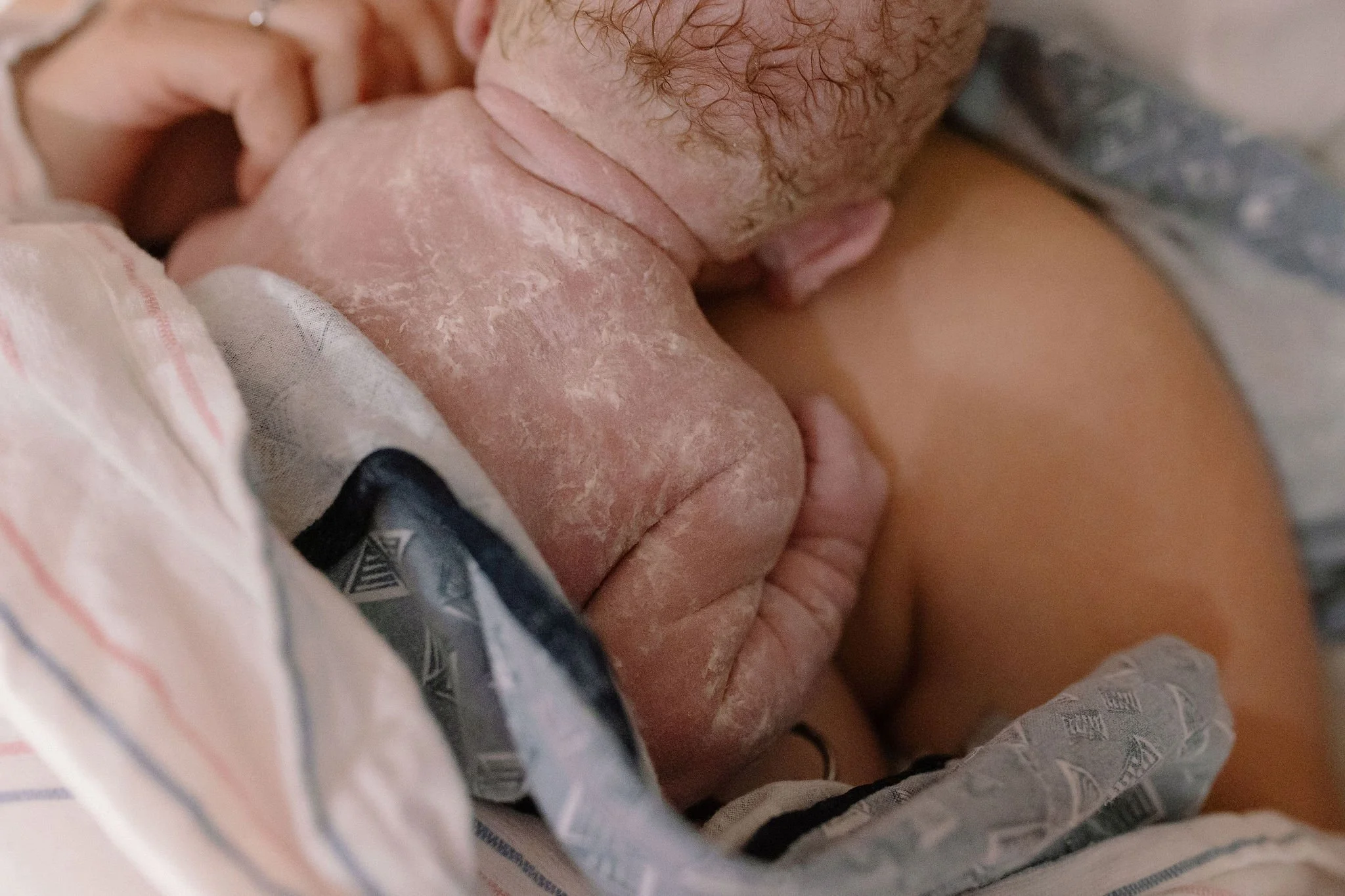 vernix on newborn baby immediately after hospital birth