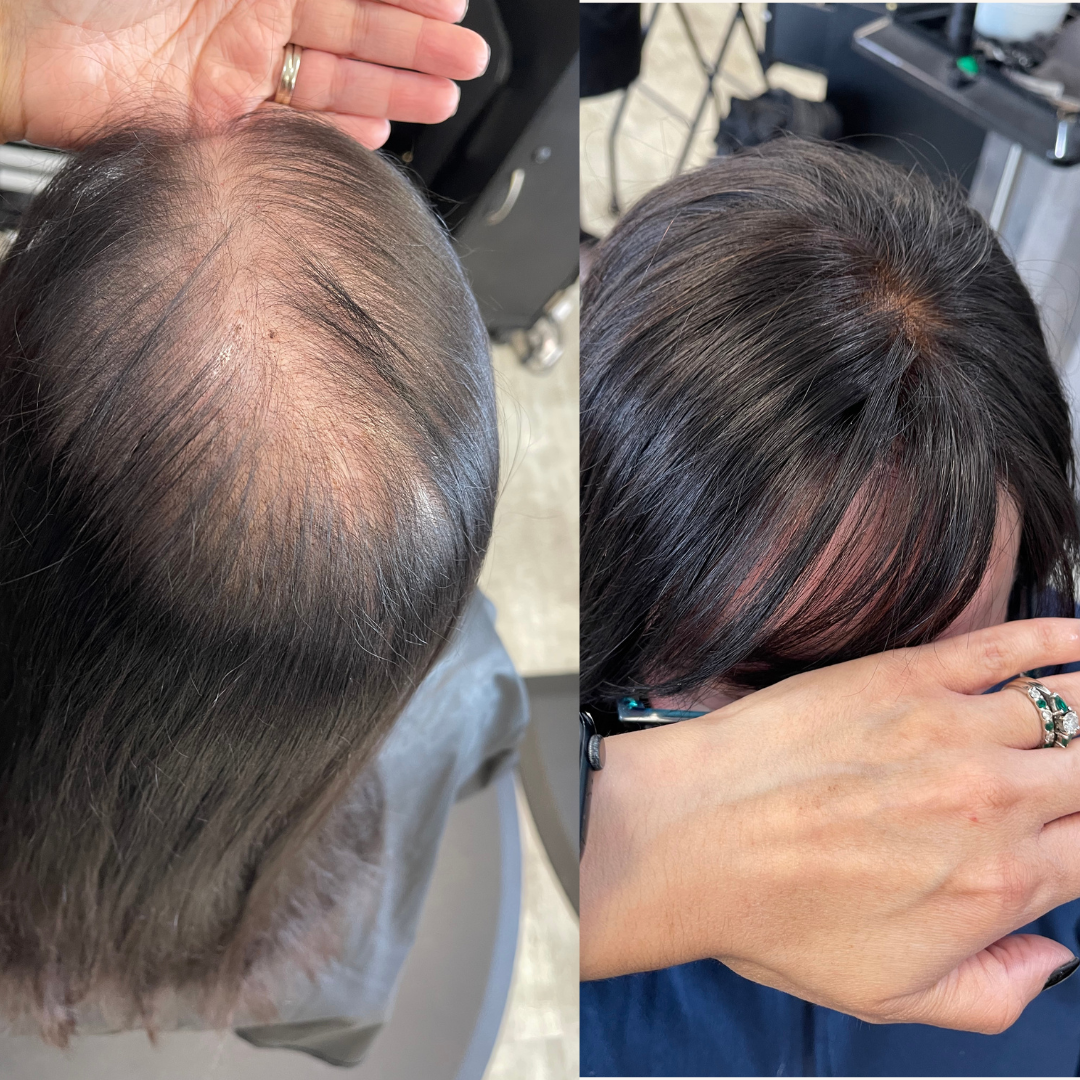 What Is Mesh Integration? A Complete Guide for Women Experiencing Hair Loss