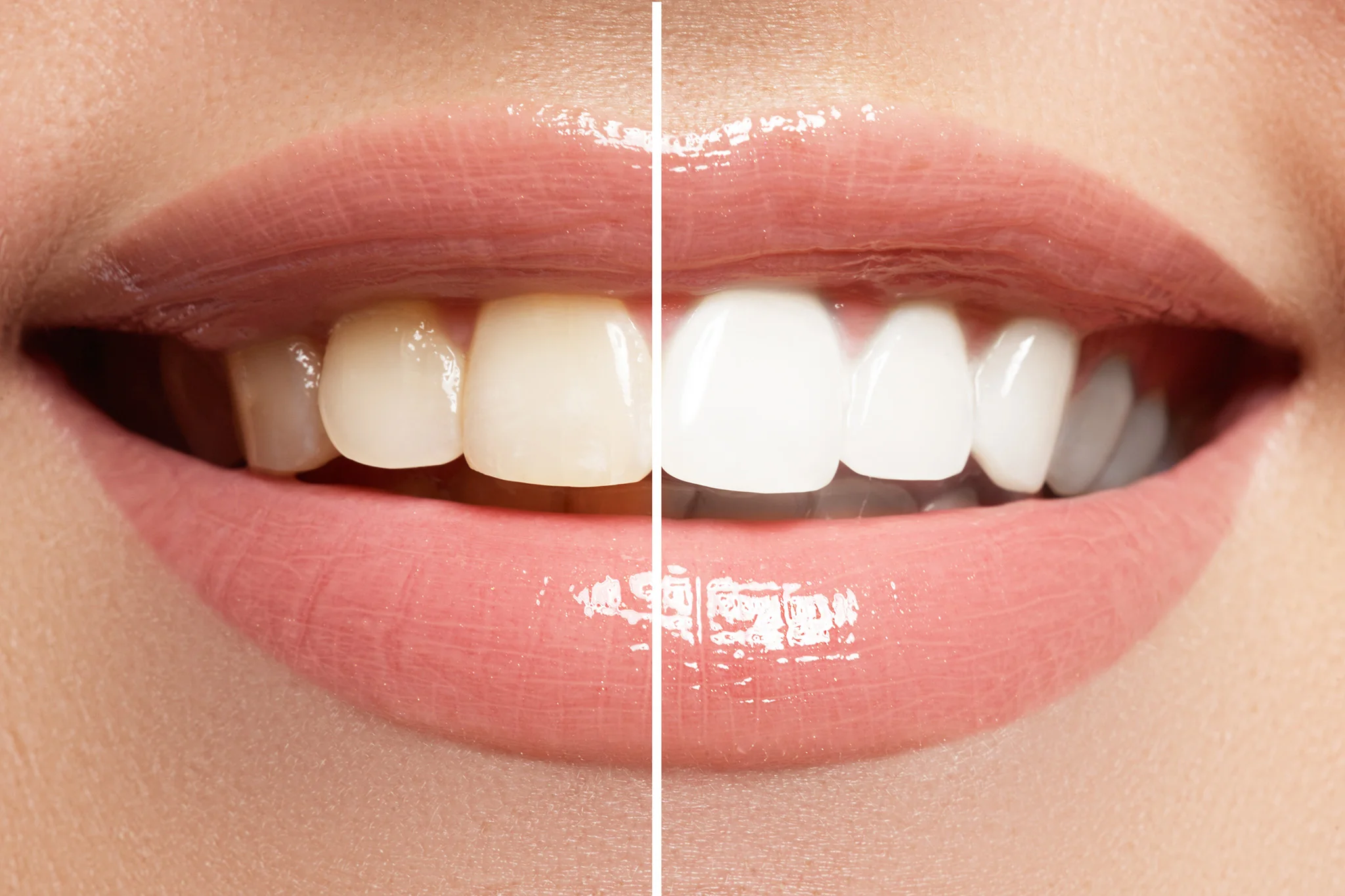 before-and-after-dental-hygienist-visit-at-family-practice-in-thanet.jpg