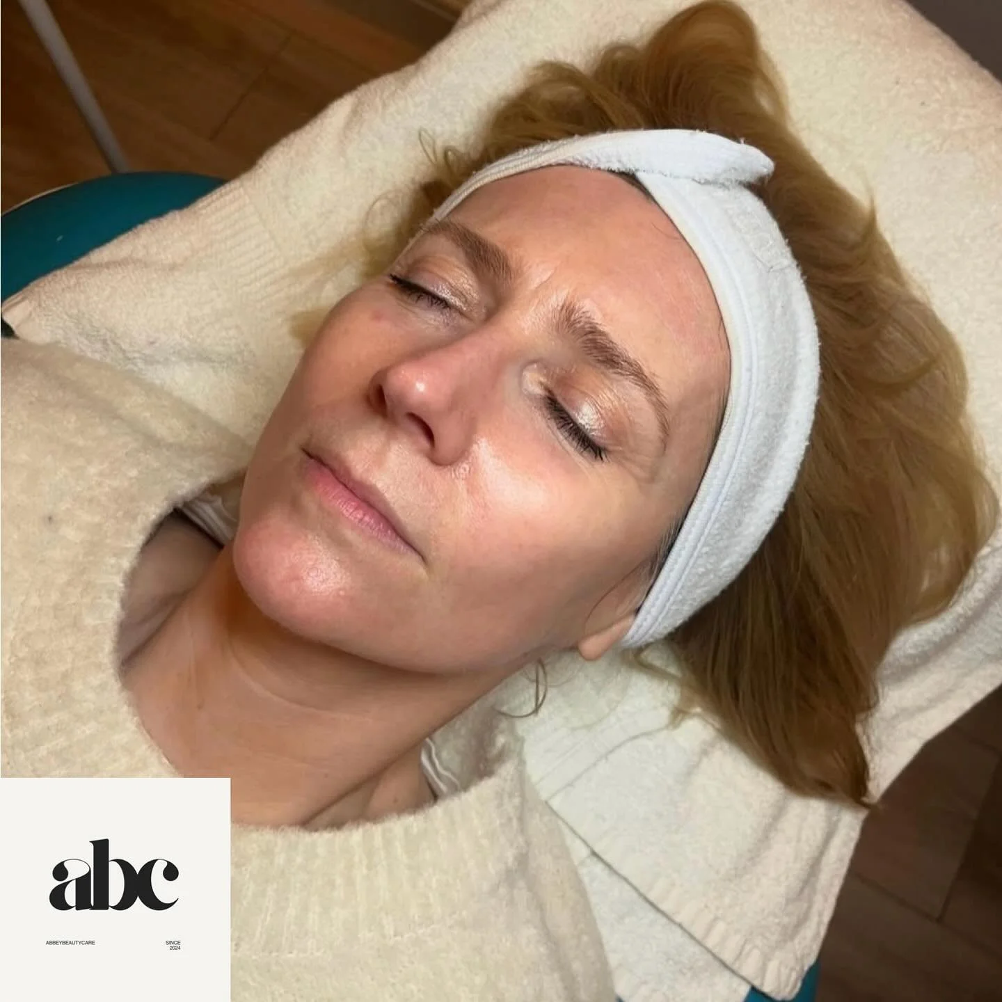 Glow for it ✨
Treat your skin to our Glow Peel offer this October 🎃
Was &pound;99 Now &pound;89 for 3 facials 😍 
Results that show immediately!!!!
Using a Glycolic acid peel to remove tired, dull skin and reveal your skins natural glow 🤩