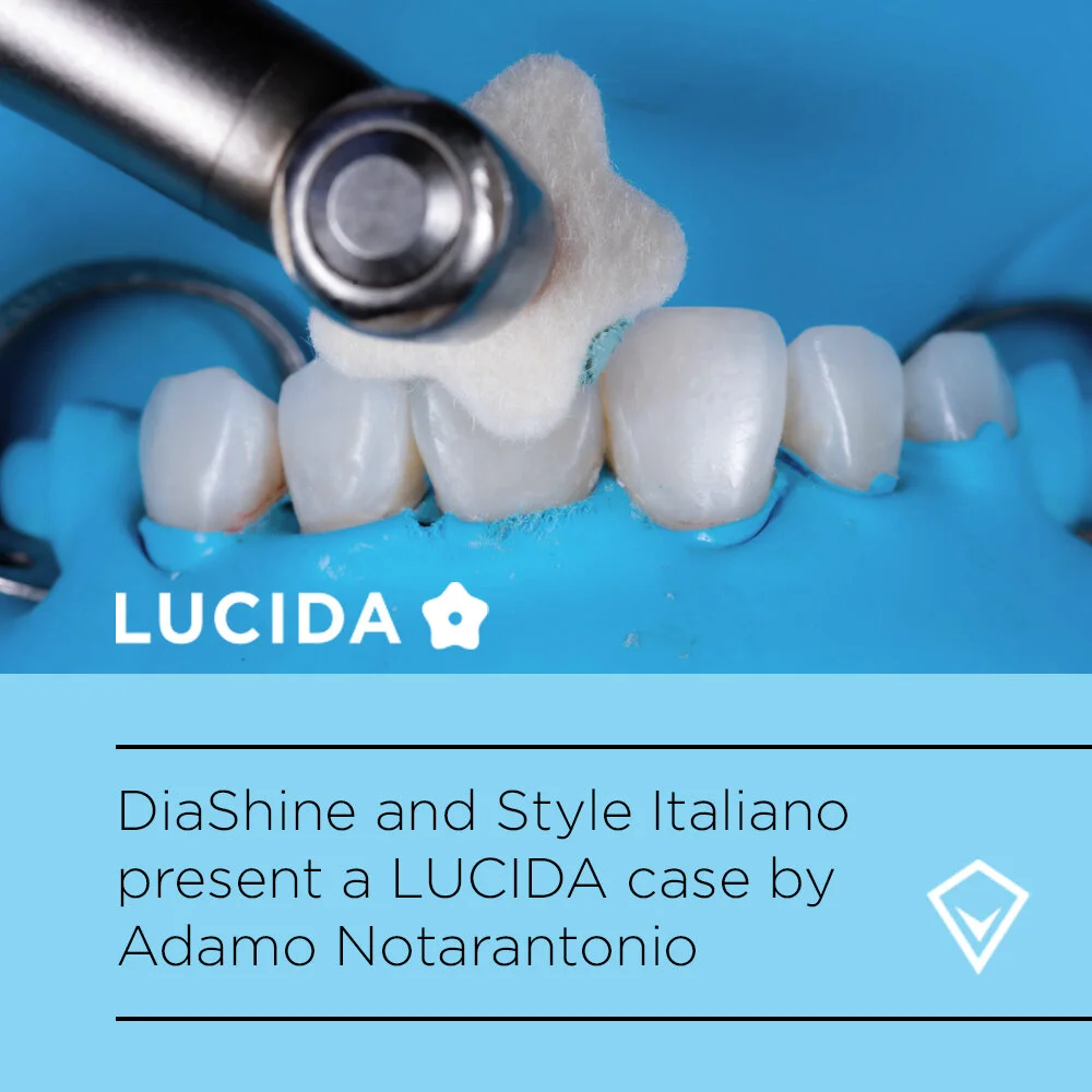DiaShine LUCIDA case by Adamo Notarantonio