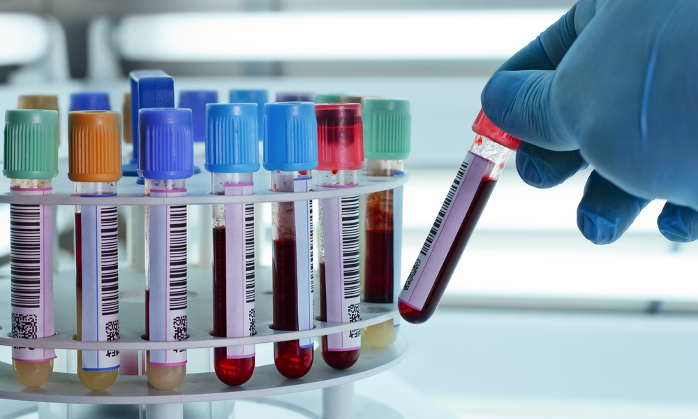 Interpretation of Basic Bloodwork Analysis (through Different Lens)