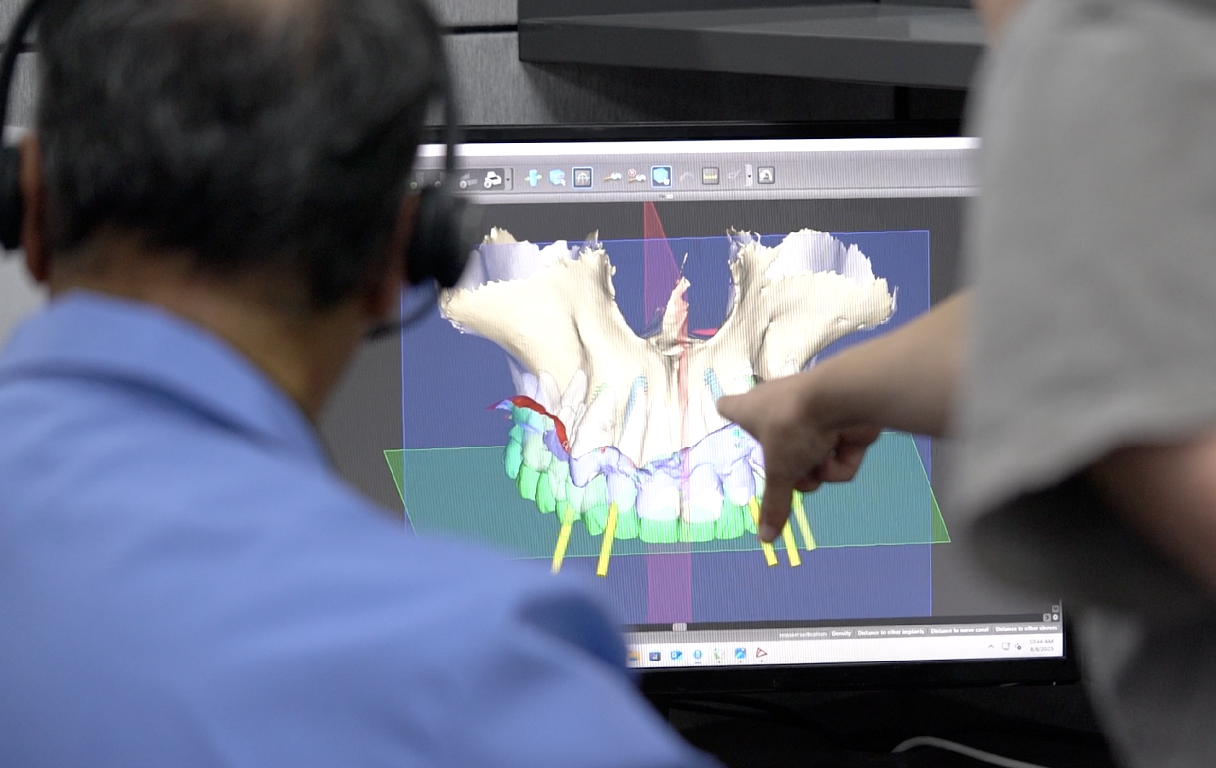 Multiple Dental Technicians Collaborating on Full-Arch Case