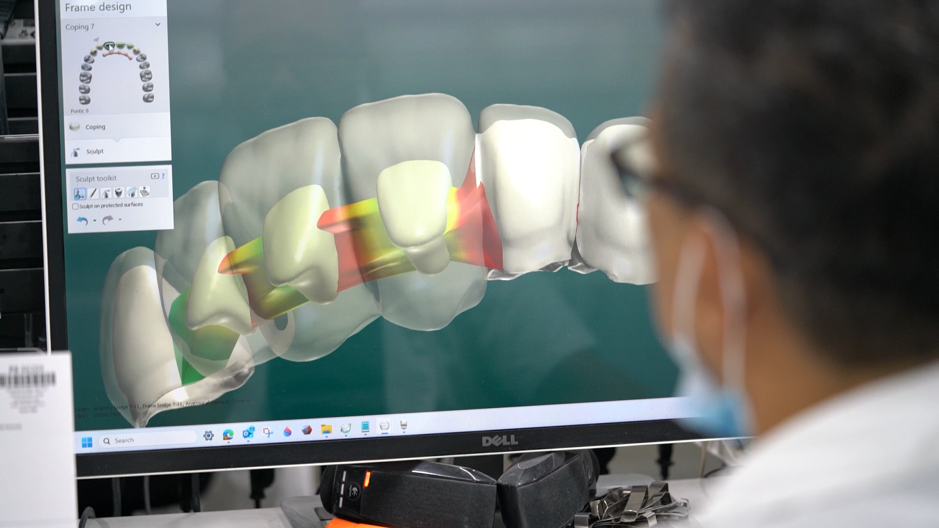 Technician Working on Digital Restorations Design