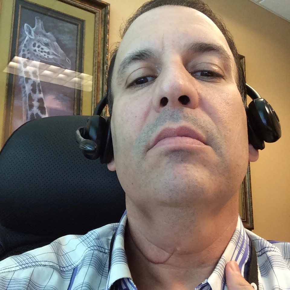 2015 - Scar looking much better. I used scar cream and sun screen.