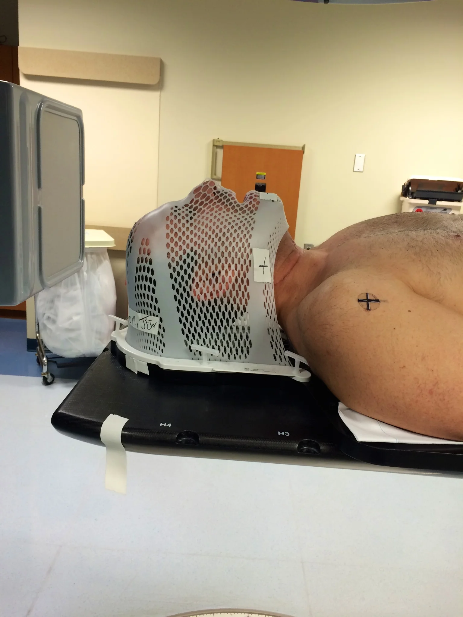 This was radiation. I had 32 rounds of radiation over seven weeks. That process lasted approximately fifteen minutes. I had a mask custom fit, so that my head could be clipped down to a table during radiation, to insure that only the necessary area of my throat was targeted. I even received a small tattoo on my chest to make certain that I was always lined up properly.
