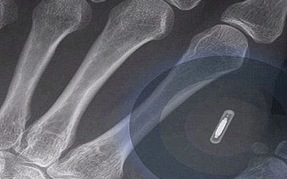 Technology Company Microchips Staff So They Can Clock-In Without IDs