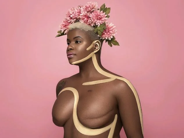 Offering Areola Repigmentation to Cancer Survivors