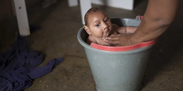 The Zika Virus Could Take a Huge Toll in the Americas