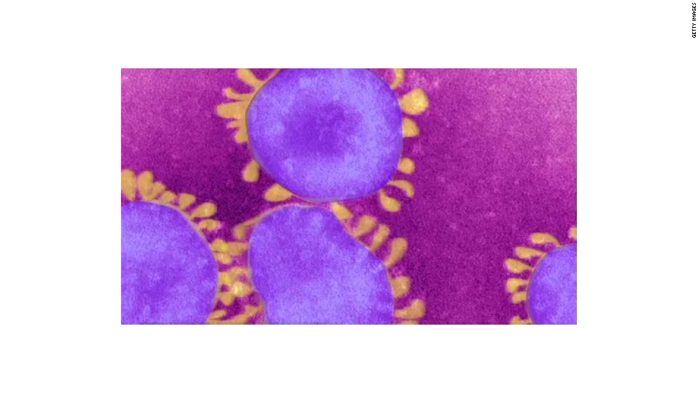 Why MERS virus is so scary