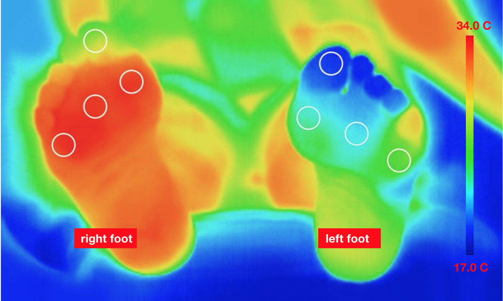hot-cold-feet.png