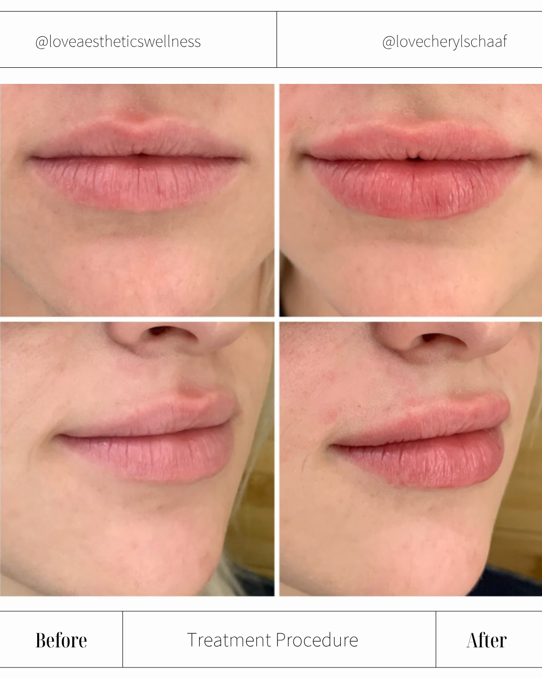 LW - 24.11 - B&A.png