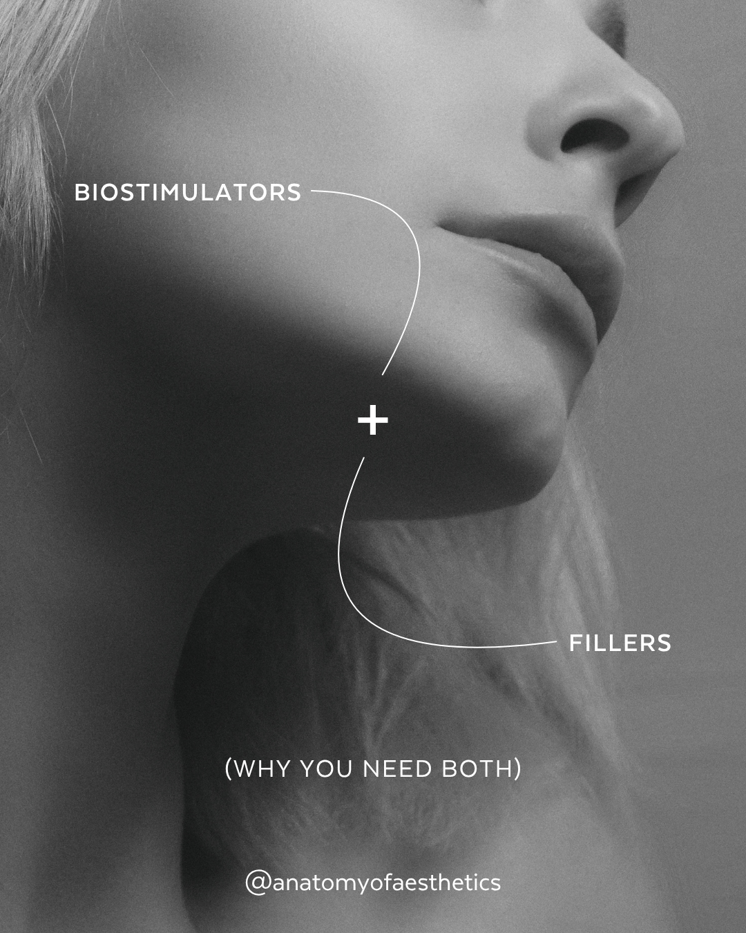 AOA - Carousel - List.png