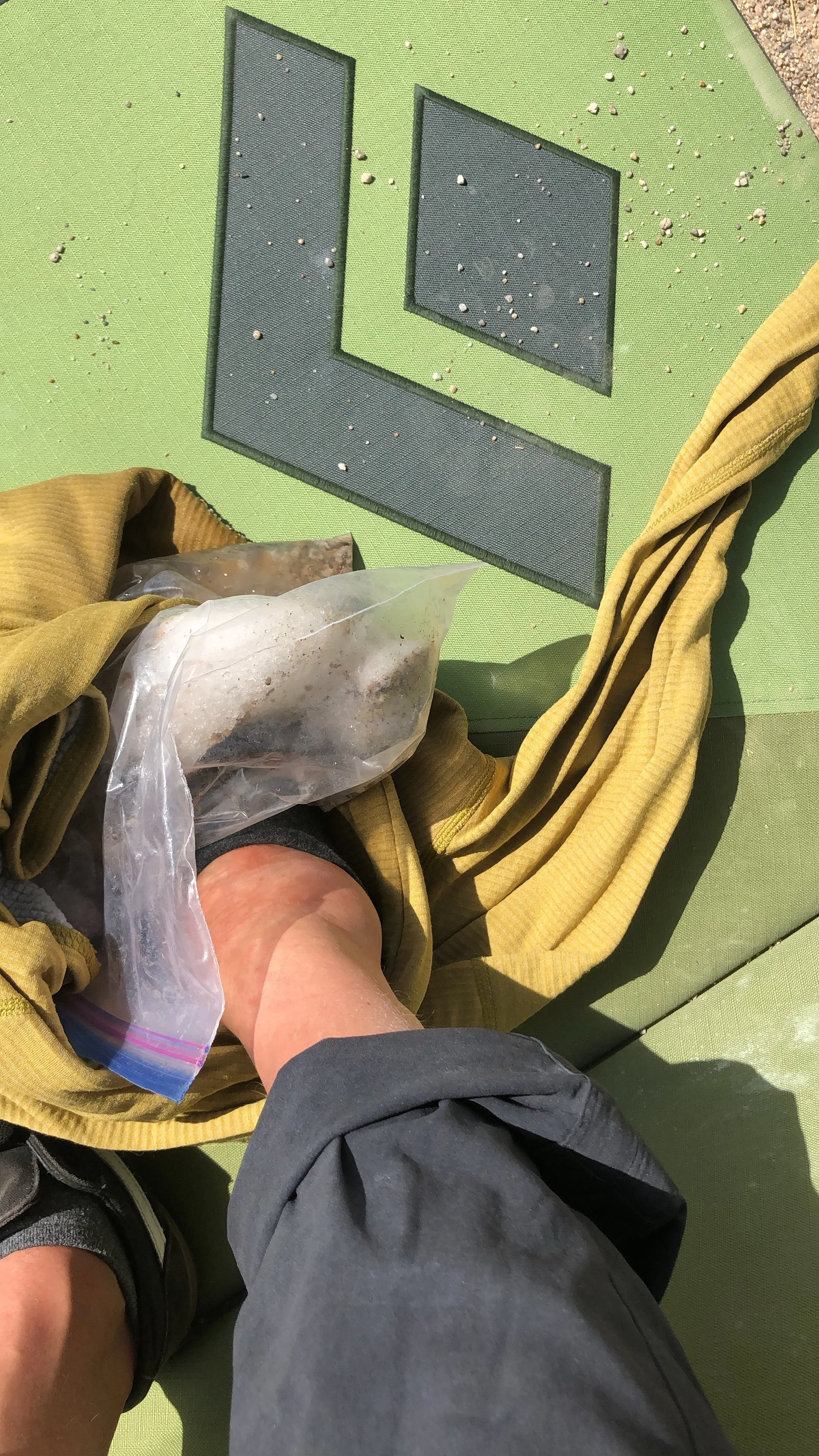 Teaching a clinic with a bag of ice 😃! It wasn’t just a sprain but also two fractures on my leg (heel bone and calf bone).