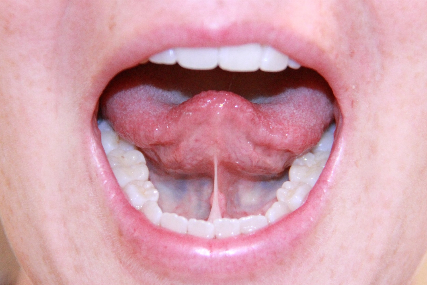 Tongue Tied!