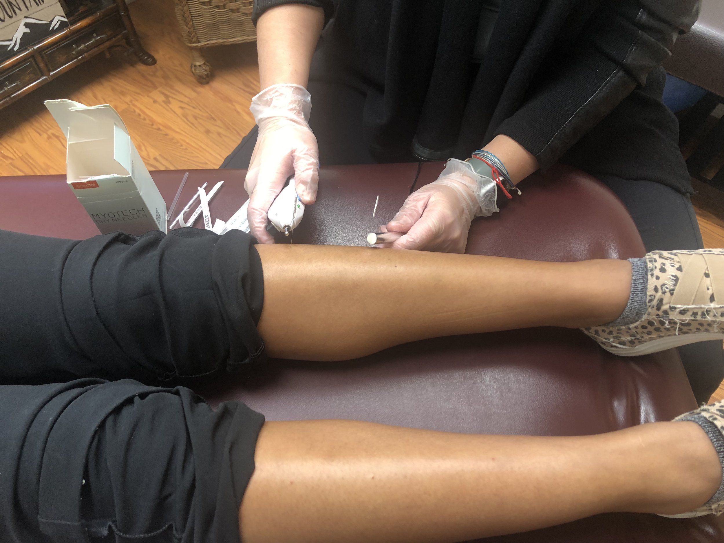 Dry needling: An innovative tool in treating pelvic-related conditions