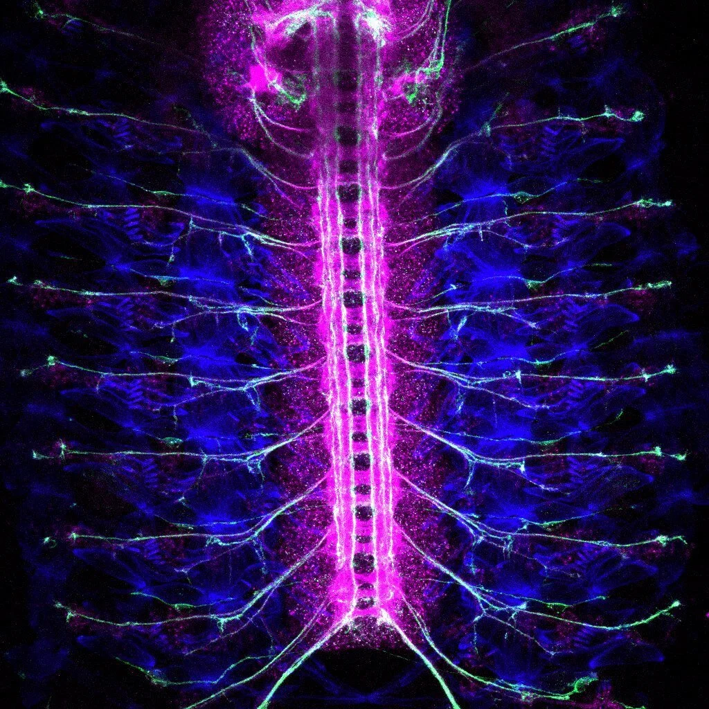 Stage 16 embryo dissection - Rio Salazar
