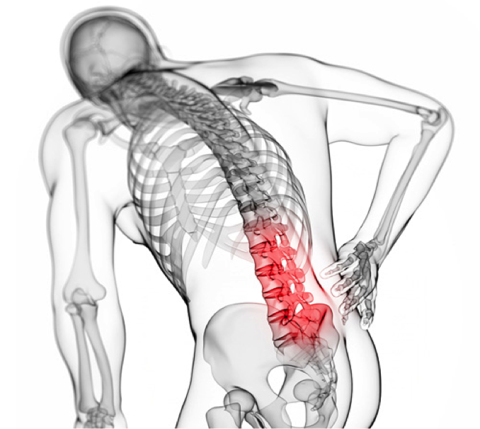 low back bent xray.png