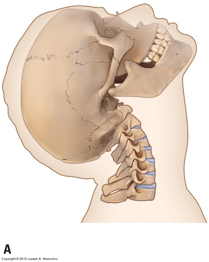 neck extension.jpg
