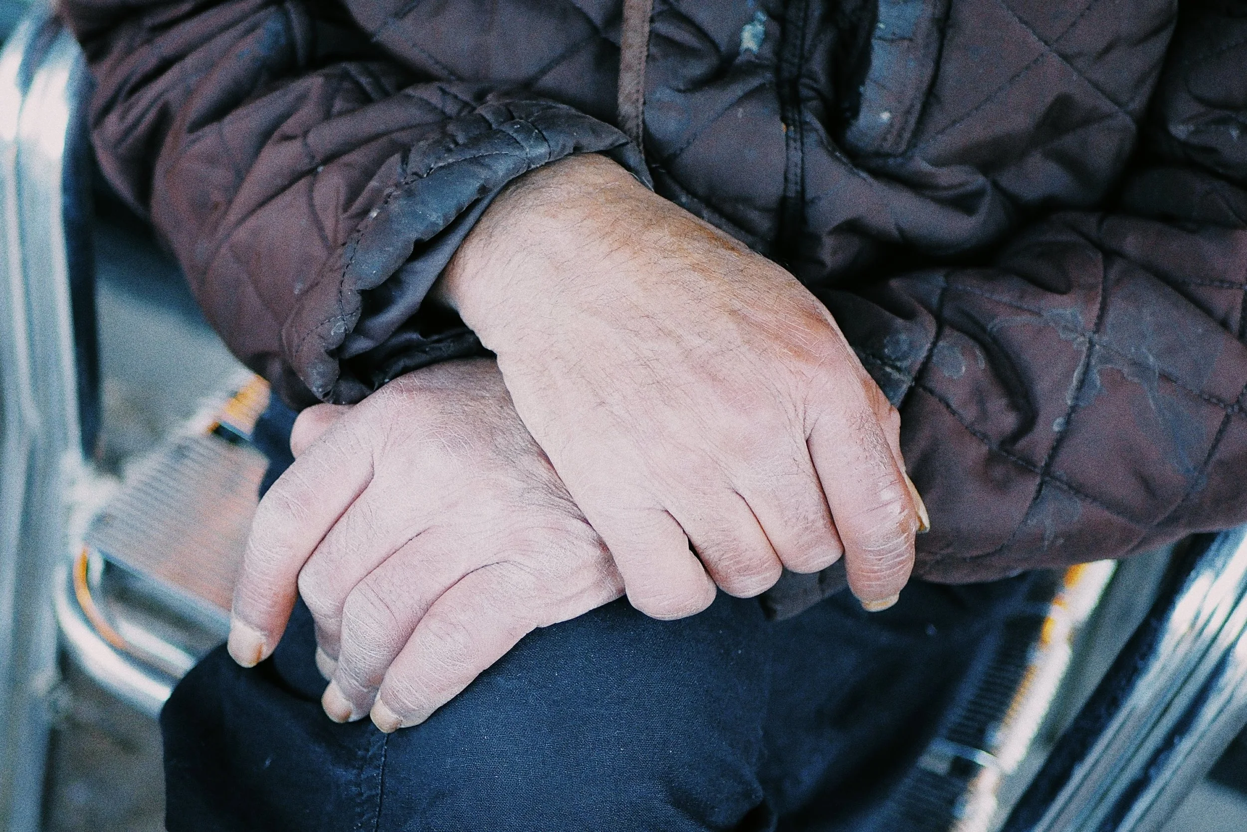Hands. 