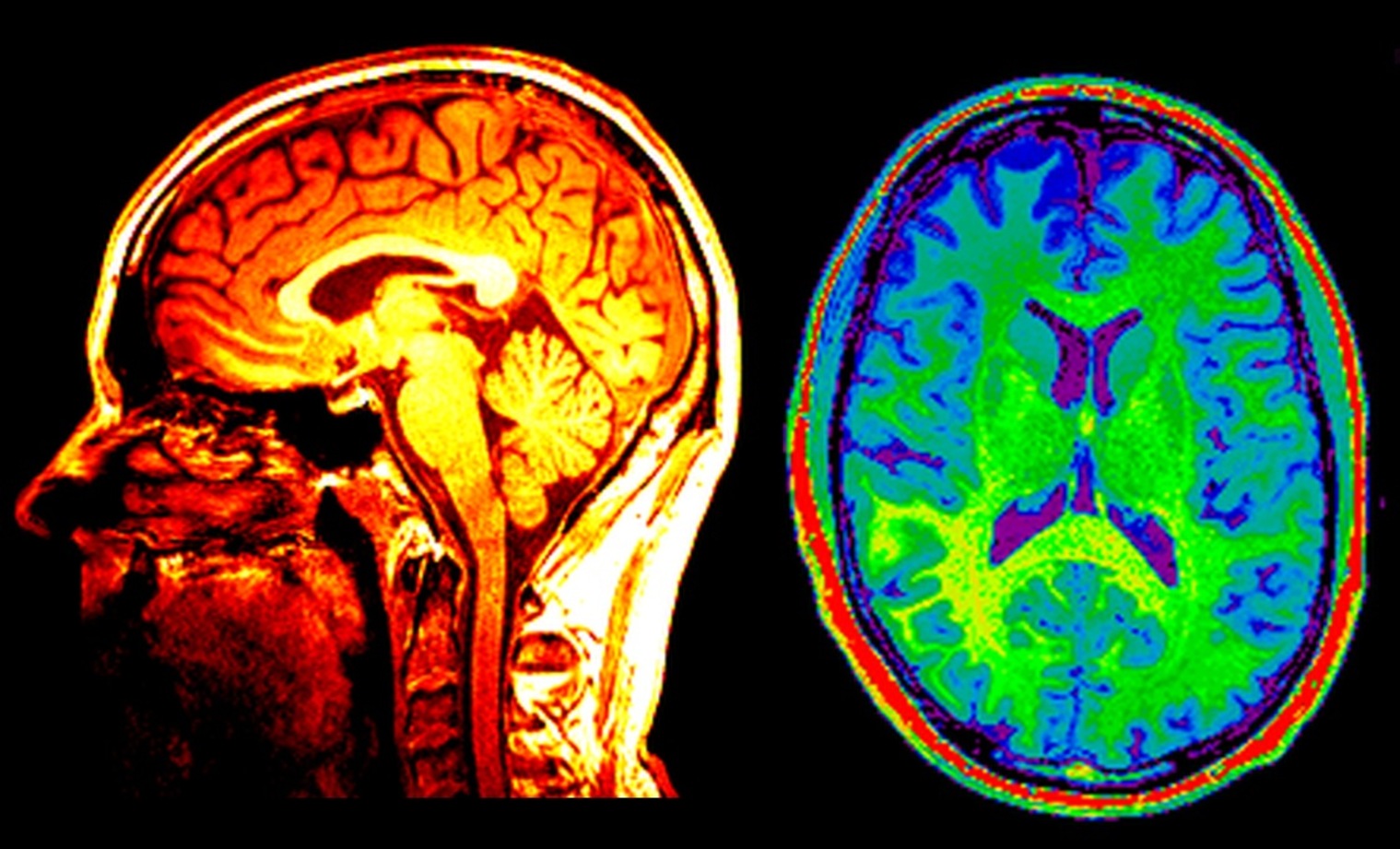 brain-scan.jpg