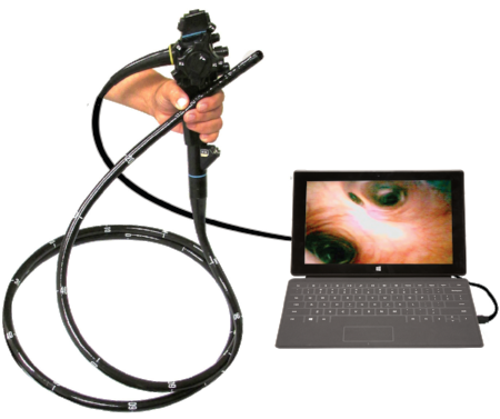 Endoscope-computer-not-included.png