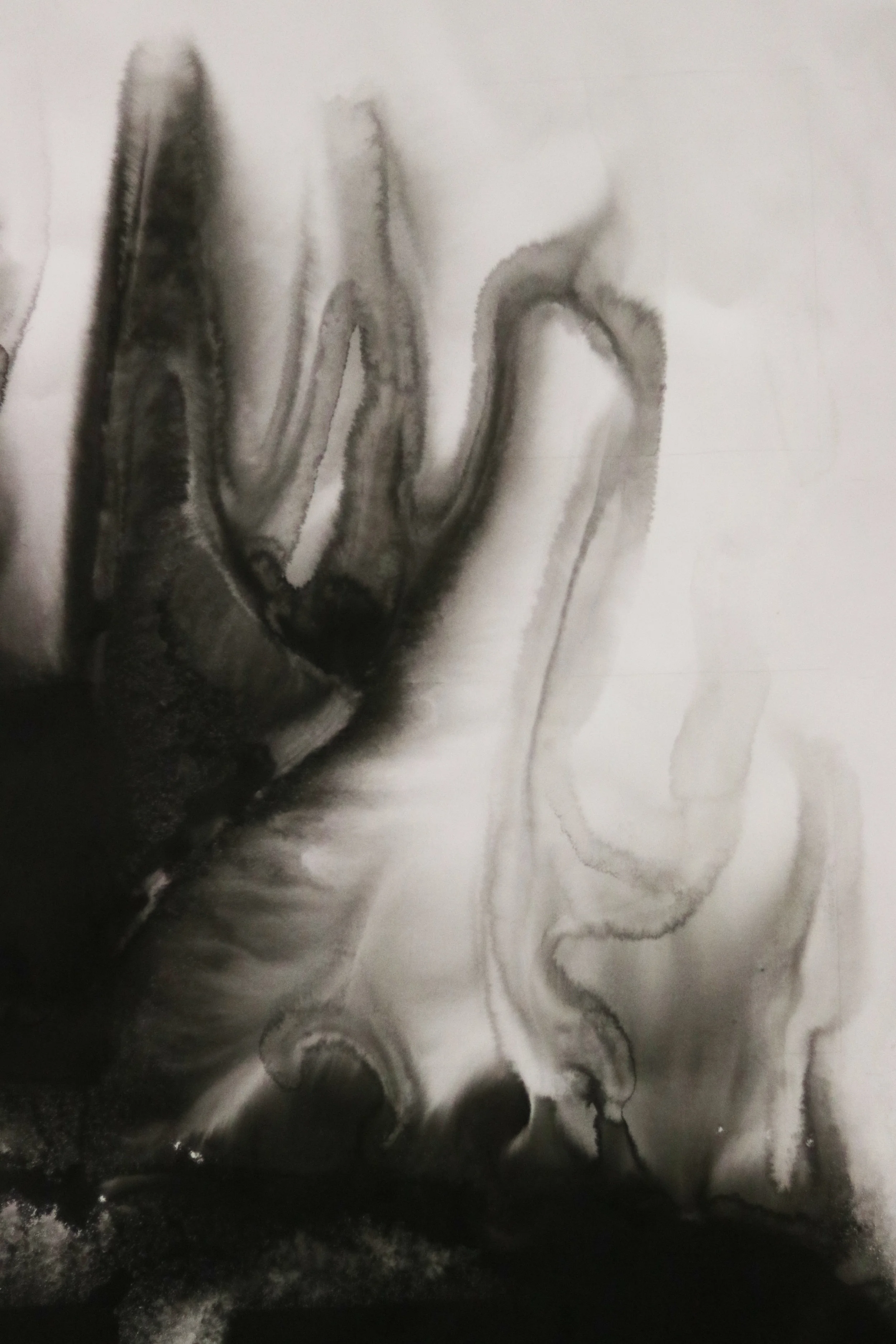 You Could Have a Functional Neurological Disorder Tomorrow
