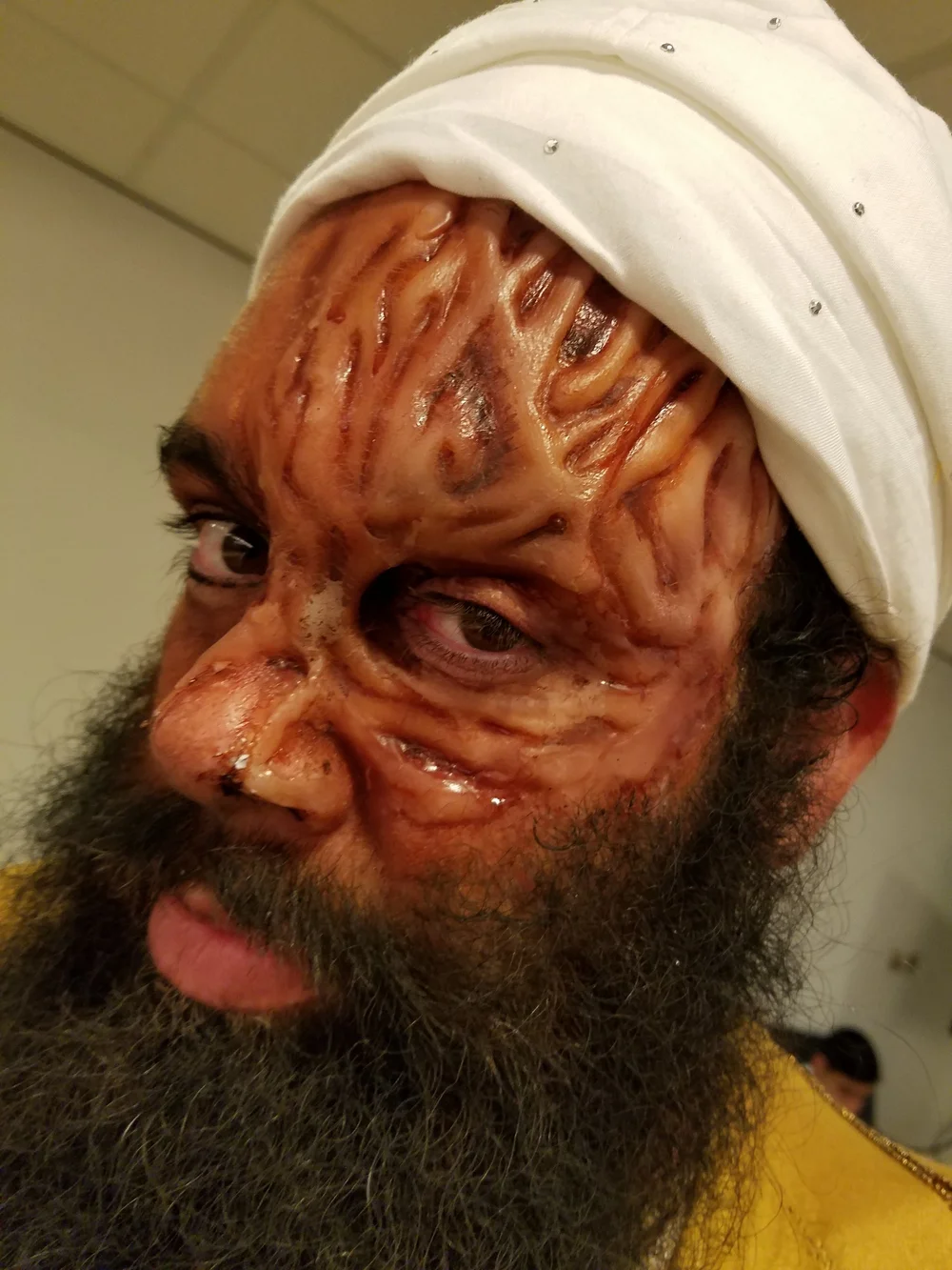 Burnt-face prosthetic makeup from Interen Shverd