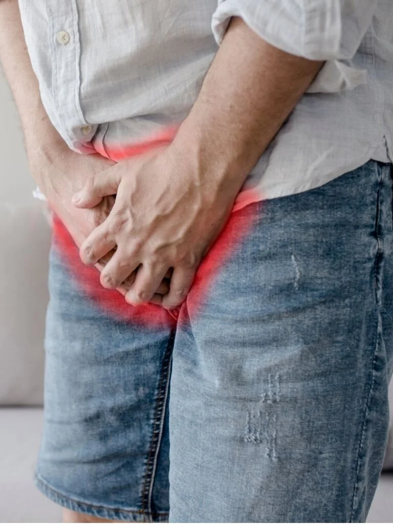 What are the Symptoms of an Inguinal Hernia in Adults?