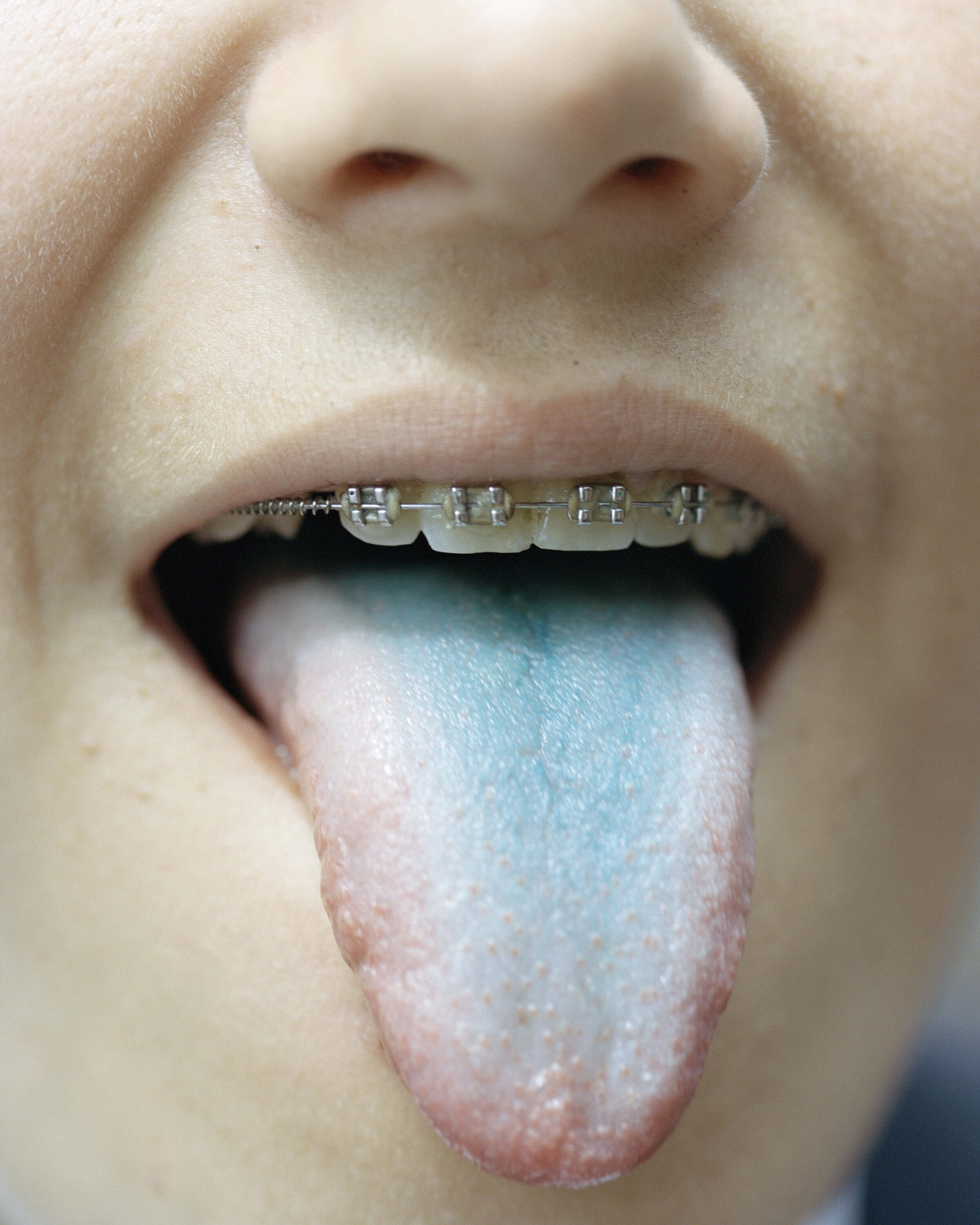 blue tongue.jpg
