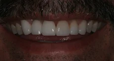 after_teeth-1.jpg